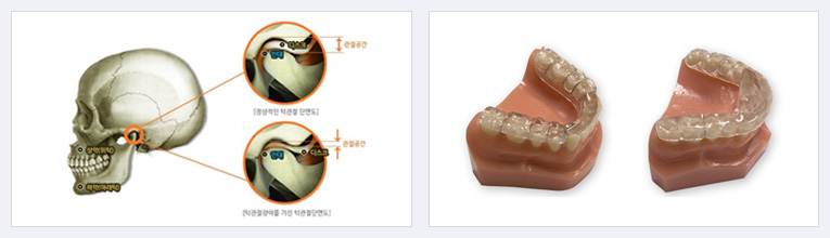턱관절질환클리닉