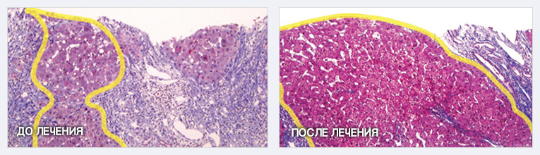 ДО ЛЕЧЕНИЯ, ПОСЛЕ ЛЕЧЕНИЯ